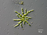 coleochaetra_pulvinata20