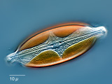 surirella_sp.