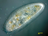 paramecium__kv__df1